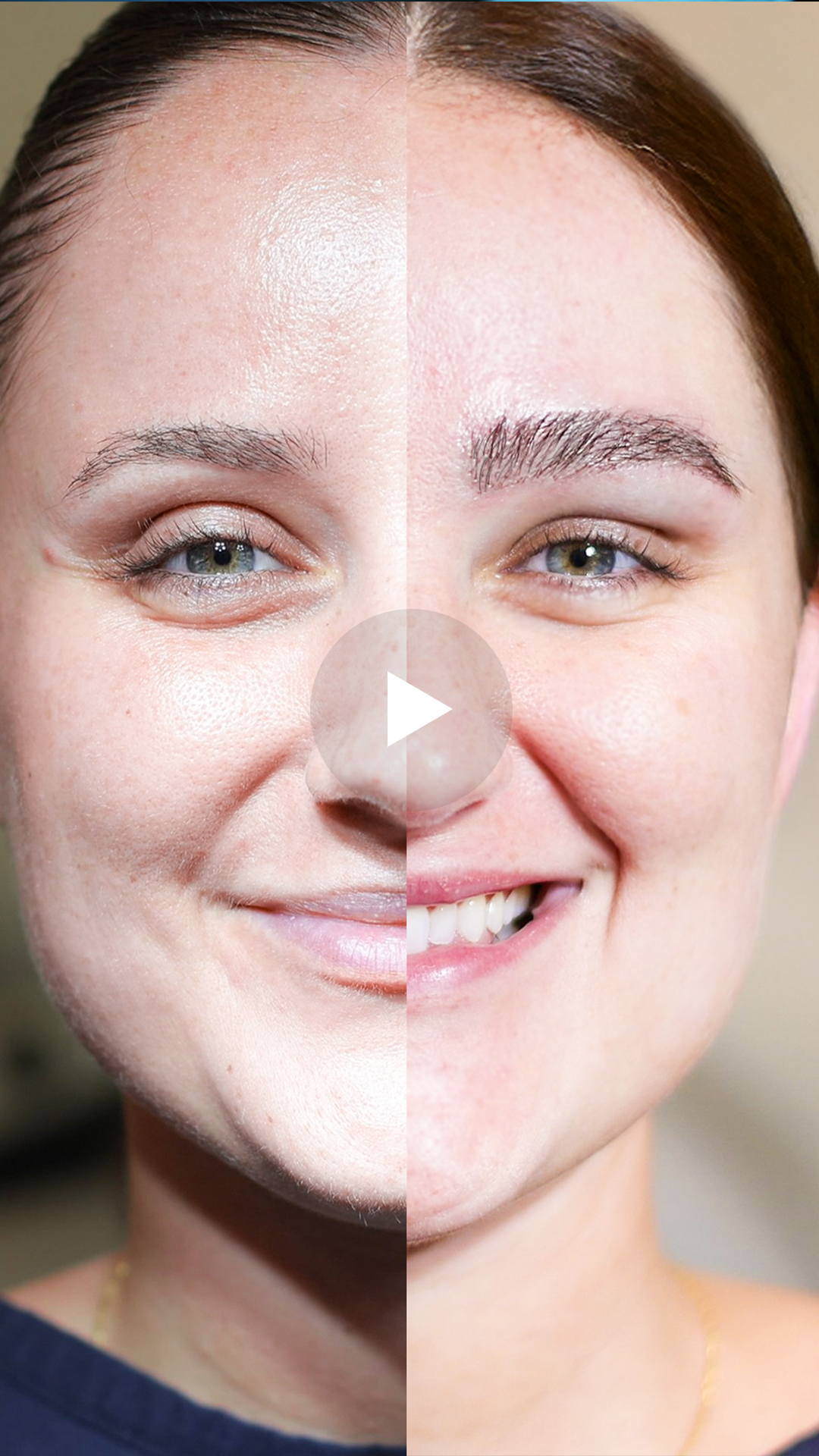 Antes e depois do transplante